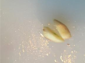 热油锅，加入一瓣蒜