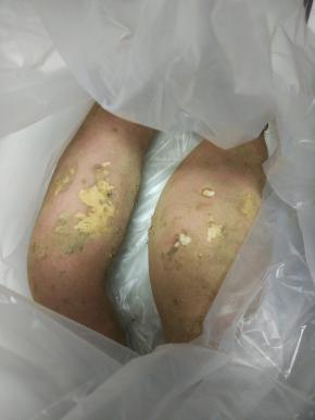 红薯清洗干净，去皮切小块,