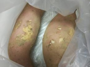 红薯清洗干净，去皮切小块,