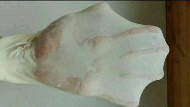 揉至扩展状态，如图所示