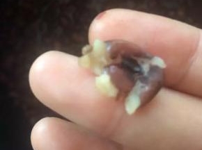 煮好的豆子不会开花，用手指轻轻一碾就碎。