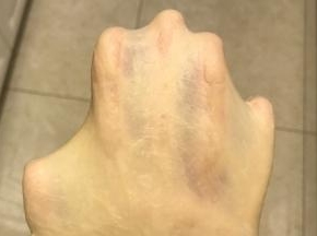 取出后看看出膜情况，正常出薄膜就可以的，要求完美的亲可配合手揉揉出手套膜。