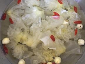 将银耳，莲子和枸杞子放入锅中，加入足量清水。