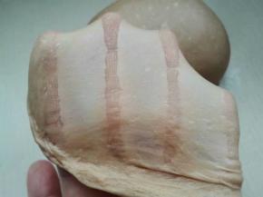 2. 揉至完全扩展状态