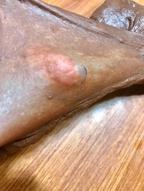 也是揉至手套膜。