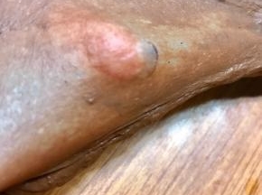 也是揉至手套膜。
