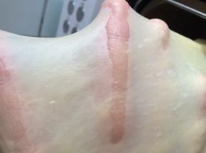 第二个imix程序结束后就可以拉出手套膜了