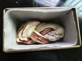 编成辫子，底部捏紧