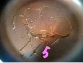 平底锅中倒入少量油，小火加热；