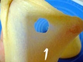 将除黄油外的材料混合均匀，放冰箱冷藏30分钟后取出；
   将面团揉至光滑，加入软化的黄油，继续揉至面筋扩展（可拉出稍微透明的薄膜，抻开的洞口呈锯齿状，面团表面光滑，有弹性。);