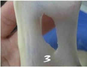 将面团揉摔至扩展阶段（可以抻出稍具透明的薄膜，戳开的洞口呈锯齿状。）；