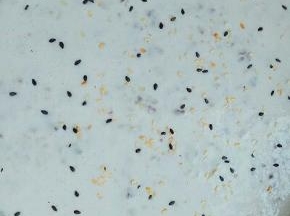 取一烤盘，铺上油纸，把酸奶倒入盘中，用刮刀搅拌，刮平，撒上熟黑白芝麻，放入冰箱冷冻室，冷冻3小时以上即可。