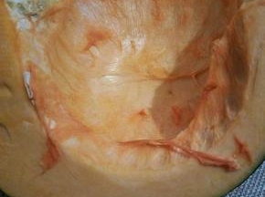 南瓜，我挑的青皮小南瓜，炸好容易定型