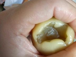 将醒发好的面糊，拿出来，放入剩下的一半面粉，用刮刀拌匀，就可以用了。称17克月饼皮，用虎口收口法包白莲蓉蛋黄馅。