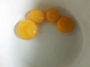 我用的4个鸡蛋，总重量238.5克，先将鸡蛋的蛋黄和蛋白分开，盛蛋白的碗需要无油无水，