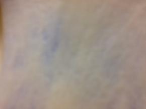 就像图片一样即可