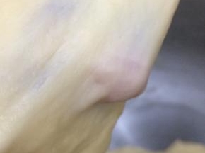 在用二档揉出扩展的膜