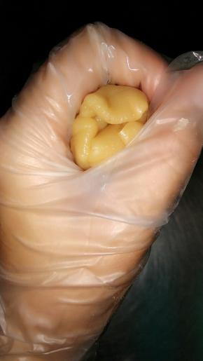 面皮往上推，用虎口收口，不能有缝隙