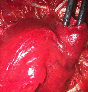 这是蒸熟后的面团，用筷子搅拌翻一下（让面团凉得快一点）