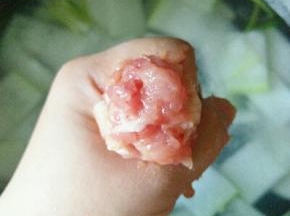 用虎口把肉挤成丸子