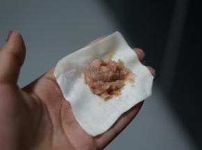 肉馅放入馄饨皮中心