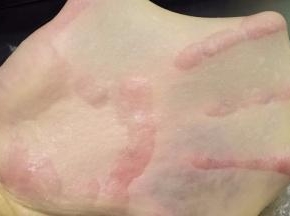 2.	薄而不易破的手套膜