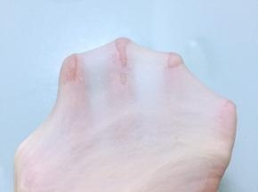 直至揉出扩展阶段