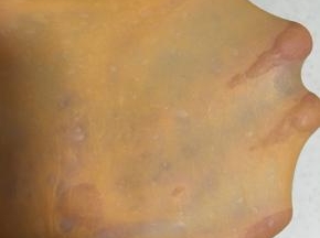 揉至出手套膜，时间大约二十五分钟