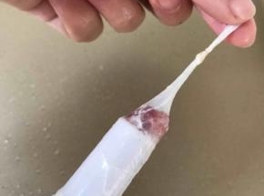 将肠衣整条的套在灌肠工具漏斗处，这一步可以先将肉馅挤压一点到漏斗口的地方，借助油脂的润滑作用，很容易就可以将肠衣套进去，肠头记得打个结