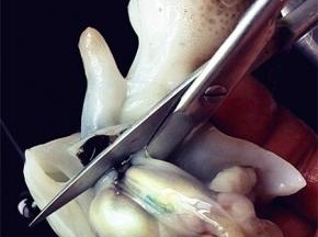 八带先冲冲水，锋利的剪子剪开布袋，剪掉墨袋