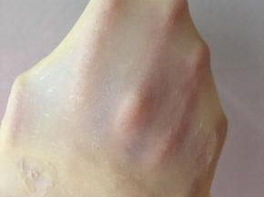 揉至扩展阶段，可以拉手套膜的样子