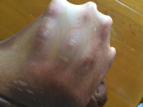 直到能拉出手套膜，就可以了