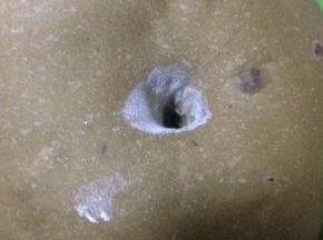 发酵到2倍大 手蘸干粉 戳洞不回缩 不塌陷