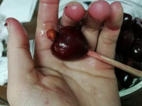 用筷子顶出核，切成小块