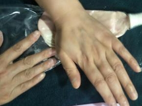 用手给它揉开