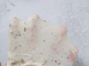 继续揉到扩展阶段