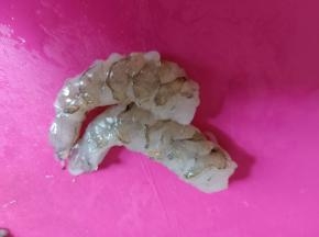 虾仁去虾肠，洗干净。
