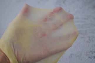 直到揉出扩展阶段