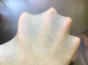揉至扩展阶段