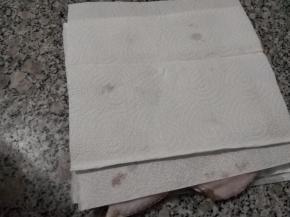 然后表面再盖上厨房纸，轻轻按压，把鸡翅的水分吸收干净。