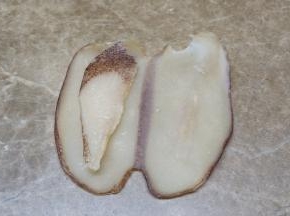 响螺片