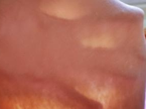 揉面至出手套膜！