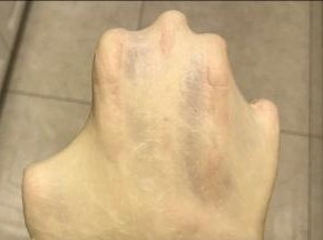 10分钟左右达到扩展阶段时加入软化的黄油，然后继续揉出手套膜。