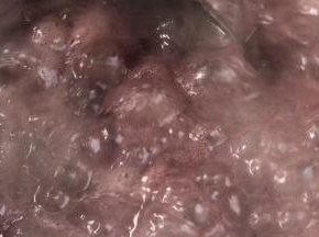 期间经常搅拌，以免粘锅，煮10分钟左右即可