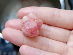 腌渍好的猪肉糜搓成小肉丸。