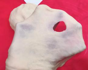 揉至初步扩展，破洞边缘有明显的锯齿形状