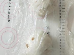 7、取出面团分割成2份，滚圆松弛15分钟。