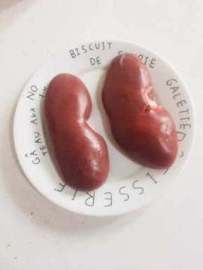 准备一对新鲜的猪腰子，清洗干净备用！