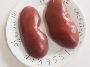 准备一对新鲜的猪腰子，清洗干净备用！