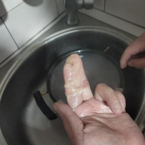 把小肠从里面翻出来！